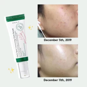 axis-y-dark-spot-correcting-glow-serum-50ml-pic-10