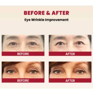 ksecret-seoul-1988-eye-cream-retinal-liposome-4percent-fermented-bean-30ml-pic-6