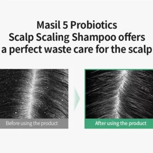 masil-5-probiotics-scalp-scaling-shampoo-pic-4