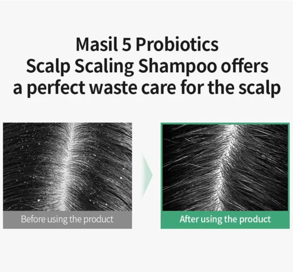 masil-5-probiotics-scalp-scaling-shampoo-pic-4