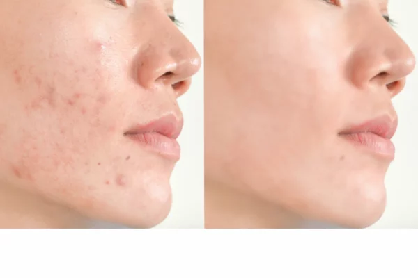 round-lab-1025-dokdo-cleanser-150ml-pic-10