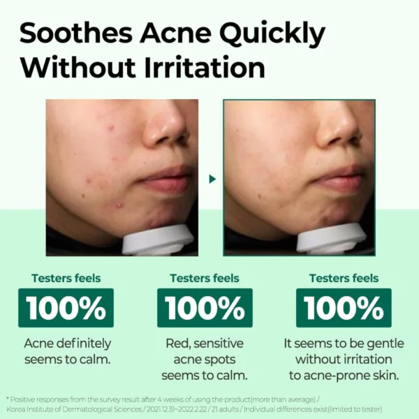 some-by-mi-aha-bha-pha-30-days-miracle-cream-60g-pic-5
