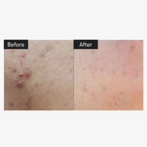 vt-cosmetics-mild-reedle-shot-50-50ml-pic-3