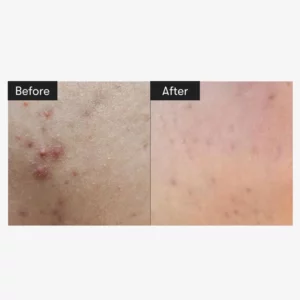 vt-cosmetics-reedle-shot-300-50ml-pic-8