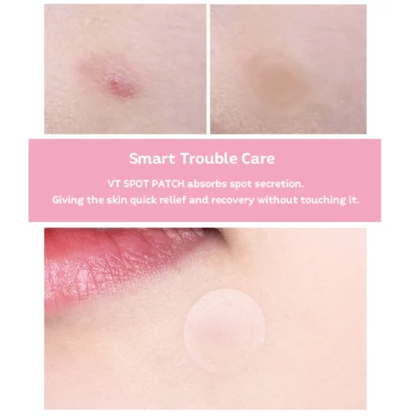 vt-cosmetics-vt-spot-patch-48pcs-pic-7