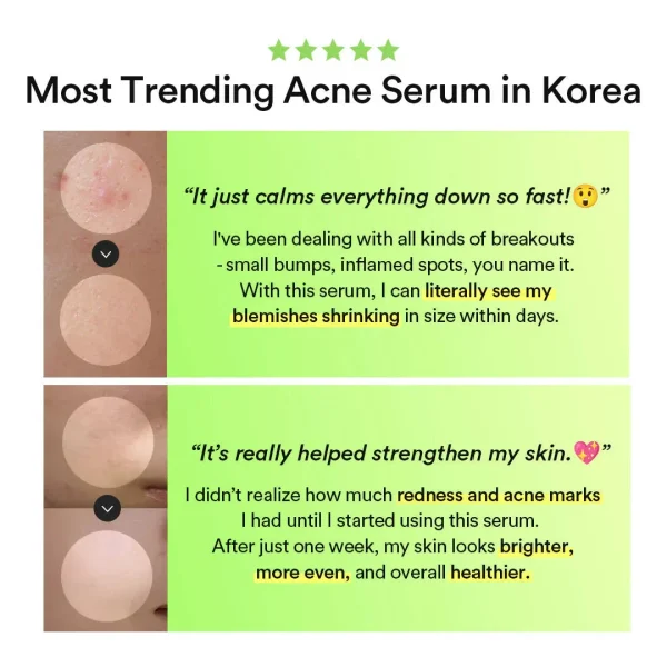 abib-heartleaf-teca-capsule-serum-calming-drop-50ml-pic-5