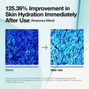 anua-pdrn-100-hyaluronic-acid-glow-pad-60pads-pic-7