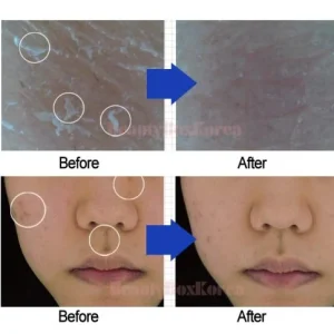 apieu-glycolic-acid-peeling-booster-120ml-pic-4