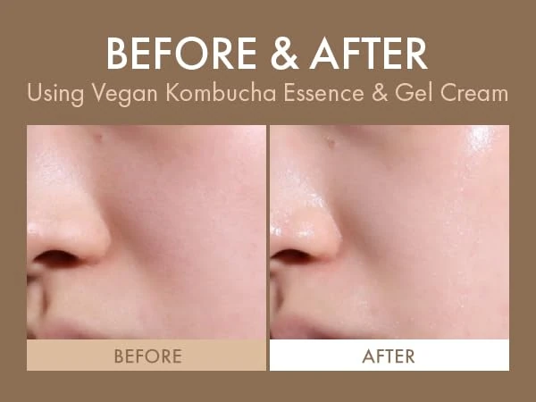 dr-ceuracle-vegan-kombucha-tea-gel-cream-75g-pic-3