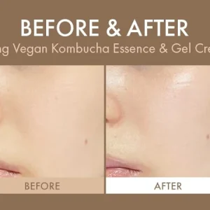 dr-ceuracle-vegan-kombucha-tea-gel-cream-75g-pic-4