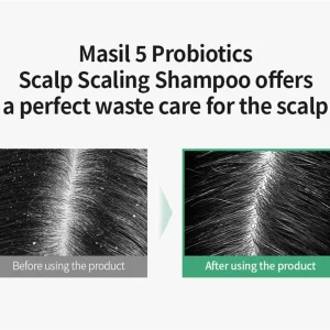 masil-5-probiotics-scalp-scaling-shampoo-pic-4