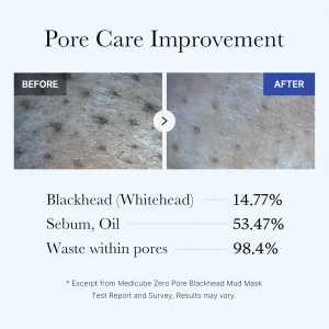 medicube-zero-pore-blackhead-mud-mask-100g-pic-4