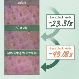 numbuzin-no3-pore-and-makeup-cleansing-balm-with-green-tea-and-charcoal-85g-pic-6