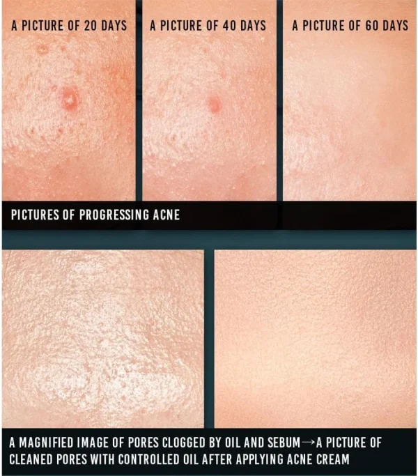 pyunkang-yul-acne-cream-50ml-pic-5