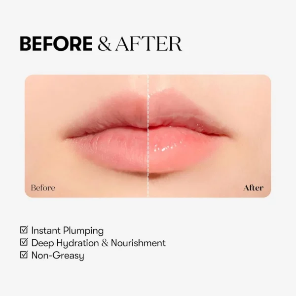 vt-cosmetics-reedle-shot-lip-plumper-beginner-43g-pic-4