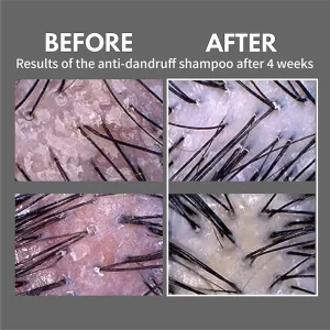 lador-dandruff-defense-shampoo-pic-2