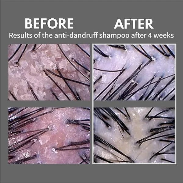 lador-dandruff-defense-shampoo-pic-2