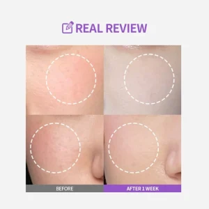 sungboon-editor-meoru-podo-vitac-dark-spot-ampoule-30ml-pic-3